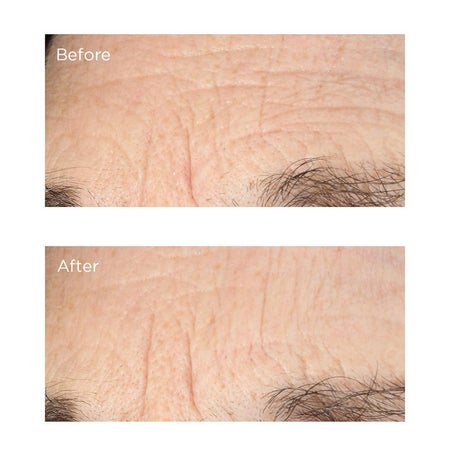 Essential Fx Acyl-Glutathione: Deep Crease Serum - Outlet Bild 3