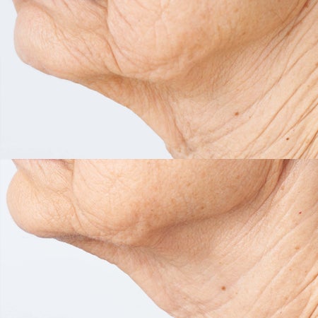 Neck Supersize (im Wert von 324 €) Bild 3