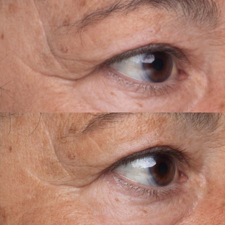 High Potency Growth Factor Firming & Lifting Eye Serum Bild 3