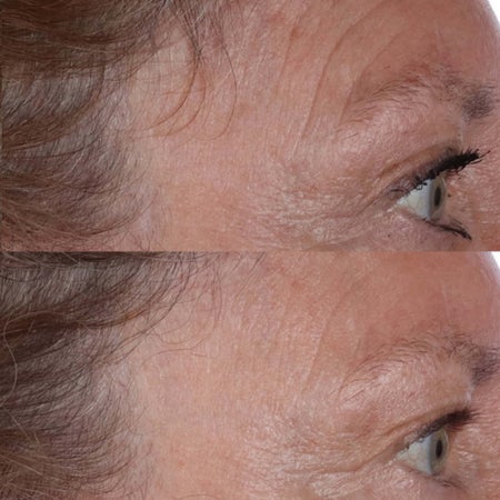 Cold Plasma Plus+ The Essence Bild 3