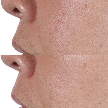 High Potency Face Finishing & Firming Toner Bild 3