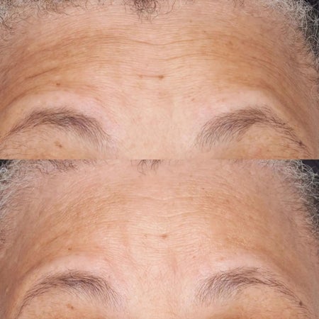 Hypoallergenic Clean Correction Barrier Repair Nourishing Moisturiser Bild 3