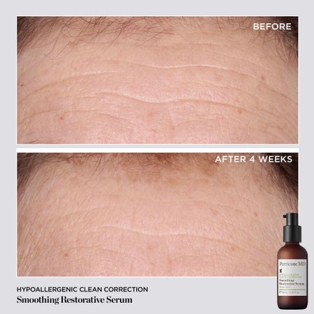 Hypoallergenic Clean Correction Smoothing Restorative Serum Bild 1